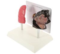 CRAFTHROU Lung Pathological Pvc for Educational Teaching Anatomy of Model Featuring Realistic and Normal and Smoking Comparison Physiology for Students