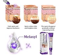 Cream For Pigmentation - Anti-Hyperpigmentation Cream | Rapid Action Advanced | Creams For Anti-Ageing Face Hyperpigmentation Treat For All Type Skin