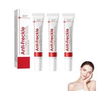 Creams for removing dark spots on the face, pigment spot remover face, cream against dark spots, brightens the skin, daily skin care (3)