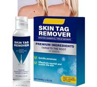 Cryo Treatment Sp/ray,Professional Tag Treatment Spray,Moisturizing Skin Remover Spray,Gentle,Soothing Remover Improves Facial Condition,Natural Tag Recede for All Skin Types