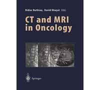 CT and MRI in Oncology