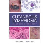 Cutaneous Lymphoma Diagnosis and Treatment