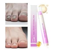 Cuticle Nail Oil | 3.5ml Nourishing Strengthener Liquid Pen - Hydrating Oil - for Women Men Daily Routine Post Manicure Evening Care Morning Salon Travel Grooming Personal Maintenance
