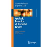 Cytologic Detection of Urothelial Lesions