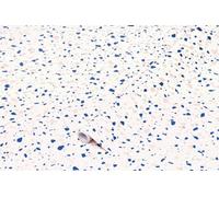 D-C-Fix Terrazzo Blue Granite Sticky Back Plastic Furniture Worktop Self Adhesive Wrap 15M X 67.5Cm
