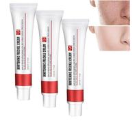 Dark Spot Correcting For Face,Whitening Freckle Cream, Skin Brightening Essence, Age Spot Corrector, Anti-Wrinkle Moisturizing Serum For Women (3PCS)