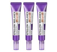 Dark spot remover for face, age spot remover reduces the appearance of old & new scars, melasma treatment cream for face, pigmentation freckles removal cream (30g, 3)