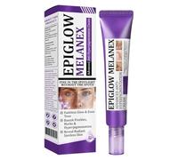 Dark spot remover for face, age spot remover reduces the appearance of old & new scars, melasma treatment cream for face, pigmentation freckles removal cream (30g, 1)