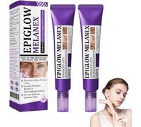 Dark Spot Remover For Face, Pigmentation Removal Cream, Ceoerty EPIGLOW MelanEX Advanced Anti-Hyperpigmentation Cream, Visibly Brightens Dark Spots, Melanin Correcting Facial Serum (2PC)