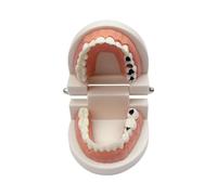 Decay Tooth Model, YOUYA Dental Caries Standard Teeth Teaching Model Study Tool Adult Disease Standard Typodont Demonstration Teeth Model for Kids Oral Care Teaching