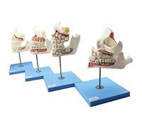 Deciduous Teeth, Permanent Teeth, Children's Teeth And Jaw Development Model, Tooth Growth 4 Stages, Children's Dentitio