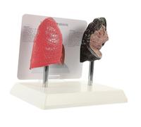 DECORNIJIA Human Lung Anatomy Model Smoking Pathological Educational Aid for Students Teachers Health Professionals with Realistic Detailed Structure for School Teaching