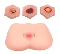 Decubitus Ulcer Care Model, Human Model, Decubitus Ulcer Training Model,4 Stages of Bedsores,Decubitus Wound Care Kit for Decubitus Wound Care Kit