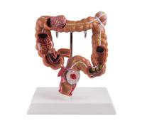 Dedjgoo Teaching Model,Human Large Intestine Anatomy Model Visceral Lesion Model Human Digestive System Learning Model Easy Install Easy to Use
