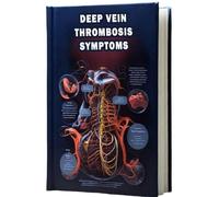 Deep Vein Thrombosis Symptoms: Learn about the symptoms of deep vein thrombosis (DVT), a blood clot in a deep vein, and the associated risks.