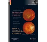 Dégénérescence maculaire liée à l'âge (DMLA) / Myopie et étiologies de la néovascularisation choroïdienne (volume 7 - coffret Rétine): (volume 7 - coffret Rétine)