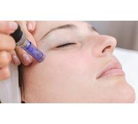 Deluxe Microneedling - Face - Single Session