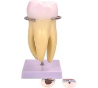 Dental Anatomy Model Molar Anatomy Model, 3 Times Single Tooth Model, Tooth Anatomical Teaching Model With Bas, Removable 3 Caries Teeth & Dental Nerve 6 Parts, for Teaching Study and Education