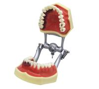Dental Calculus Removal Practice Model - Periodontal Anatomy Model for Medical Teaching, Demonstration & Doctor-Patient Communication (Subgingival Scaling Training)