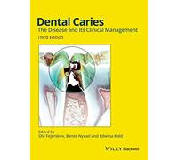 Dental Caries: The Disease and its Clinical Management