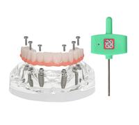 Dental Implant Model,Implant Overdenture Restoration Typodont, Maxilla All on 6 Overdenture Treatment Model,Transparent Base with 6 implants