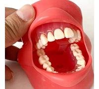 Dental Implant Teeth Model, Demonstration Teeth Model Dental Oral Simulation Simple Head Mold Tooth Extraction Practice Model Medical Teaching Learning Tool.