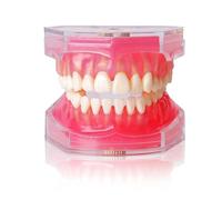 Dental Implant Teeth Model with Removable Resin Teeth & Soft Gum for Oral Surgeons, Dental Students Practice