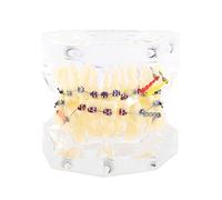 Dental Model with Braces, Orthodontic Dental Model Teeth Model Teeth for Children with Wire Chain Dental Orthodontic, Dental Model Demonstration Tool for Dental Teaching or Oral Care