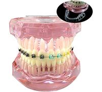 Dental Orthodontic Demonstration Model,Dental Teeth Orthodontic Retainer Treatment Model with Metal Self-ligating Brackets Explaining Model