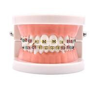 Dental Orthodontic Demonstration Model, Treatment Model Adult Teeth Gums Standard Demonstration Tool Teaching Model, for Dentist Teaching Research Dental Laboratory,A
