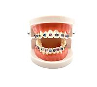 Dental Orthodontic Demonstration Model with Metal Bracket,Arch Wire Standard Teeth Model with Braces (Brackets)