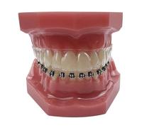 Dental Orthodontic Model With Retainer Invisible Bracket Braces Typodont Teeth Braces For Studying Teaching Demonstration