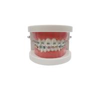 Dental Orthodontic Model, YOUYA DENTAL Demonstration Orthodontic Model Teeth Teach Study Tools with 1/2Metal and 1/2Metal self-Locking Bracket(Red)