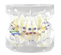 Dental Orthodontic Typodont Teeth Model with Metal Brackets and Ligature Ties for Teaching and Practice