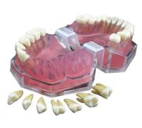 Dental Practice Model Educational Dental Tool Gums Full Disassembly Learning Exercises Tooth Extraction Full Mouth Disassembly Tooth Model for Dental Teaching Or Dentist to Communicate with Patients