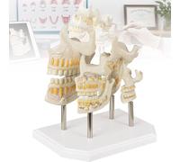 Dental Teeth Development Model 4-Stage Deciduous Permanent Tooth Growth Comparison Typodont Detachable Primary Tooth Replacement Anatomy Demonstration for Dentist Medical Student Office