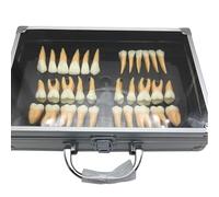 Dental Teeth Model, 32pcs Adult Teeth Model Kit, 2.5 Times Magnified Two-coloured Permanent Teeth, High Simulation, with Aluminium Storage Case, for Teacher, Student, Dentist Office Educational Tool