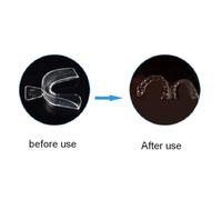 Dental Teeth Whitening Trays Retainers 2/4pcs Tooth Orthodontic Braces Set Mouth Guard Protector Oral Care (Two)