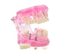 Dental Transparent Disease Teeth Model lmplant Analysis Demonstration Standard Typodont Training Tooth with Removable Crown Bridge for Student Education（Blue）(Pink)