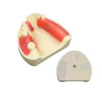 Dental Typodont Teeth Model Implant Practice Overdenture Restoration Demo for Study Teach Lower Jaw Removable Gingiva (M2004)