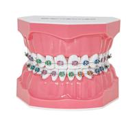 Dentalmall Dental Teeth Orthodontic Demonstration Model Typodont Teaching,Studying,Explaining Model for Adult and Children