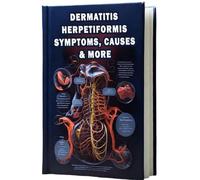Dermatitis Herpetiformis Symptoms, Causes & More: Discover the symptoms and underlying causes of dermatitis herpetiformis, a skin condition associated with celiac disease.