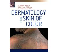 Dermatology for Skin of Color