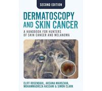 Dermatoscopy and Skin Cancer, second edition : A handbook for hunters of skin cancer and melanoma
