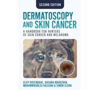 Dermatoscopy and Skin Cancer, second edition : A handbook for hunters of skin cancer and melanoma