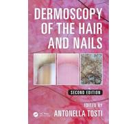 Dermoscopy of the Hair and Nails