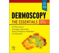 Dermoscopy : The Essentials
