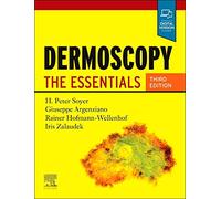 Dermoscopy: The Essentials