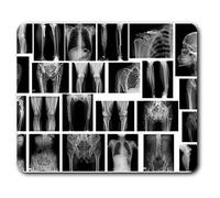 Destination Vinyl ltd X-Ray Bone Fracture Plate Pins Mouse Mat Pad Computer PC Laptop Gaming Office Home Desk Accessory Gadget #43026