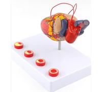 Detachable 1:1 Life Size Human Heart Bypass Model with Thrombosis for Learn丨Realistic Anatomically Accurate Human Heart Model with 34 Digital Signs for Classroom Teaching Tool